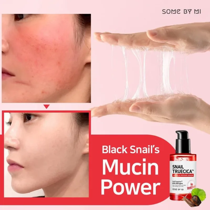 ⁦🧴 سيروم إصلاح البشرة سنيل تروسيكا ميراكل – 50 مل  Some By Mi Snail Truecica Miracle Repair Serum – 50ml⁩ - الصورة ⁦2⁩