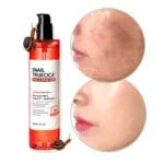 🧴 سوم باي مي – تونر سنايل تروسيكا ميراكل لإصلاح البشرة – 135 مل Some By Mi Snail Truecica Miracle Repair Toner – 135ml