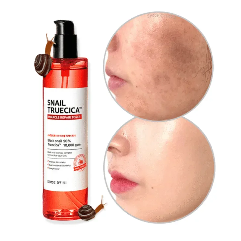 🧴 سوم باي مي – تونر سنايل تروسيكا ميراكل لإصلاح البشرة – 135 مل  Some By Mi Snail Truecica Miracle Repair Toner – 135ml